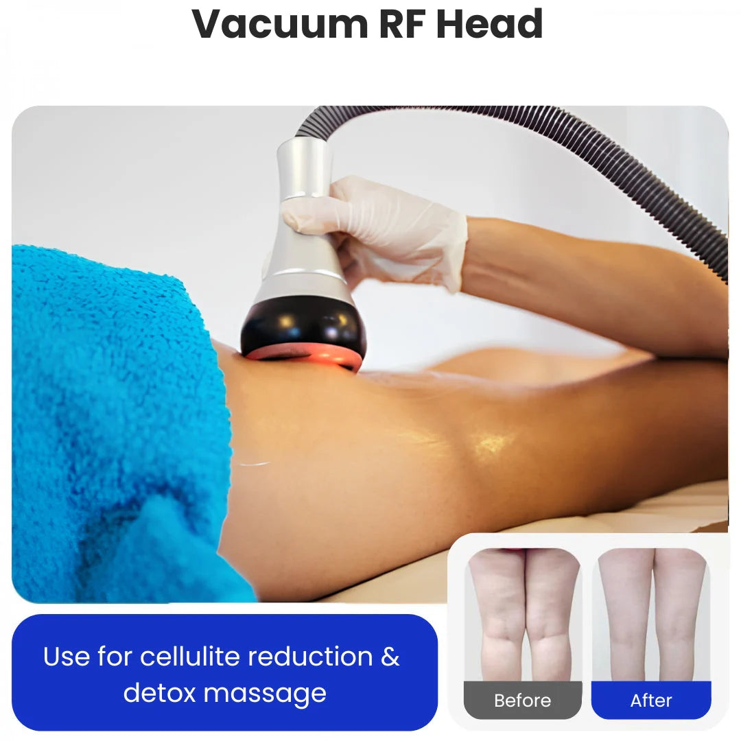 LipoBlast Ultrasonic Cavitation Machine