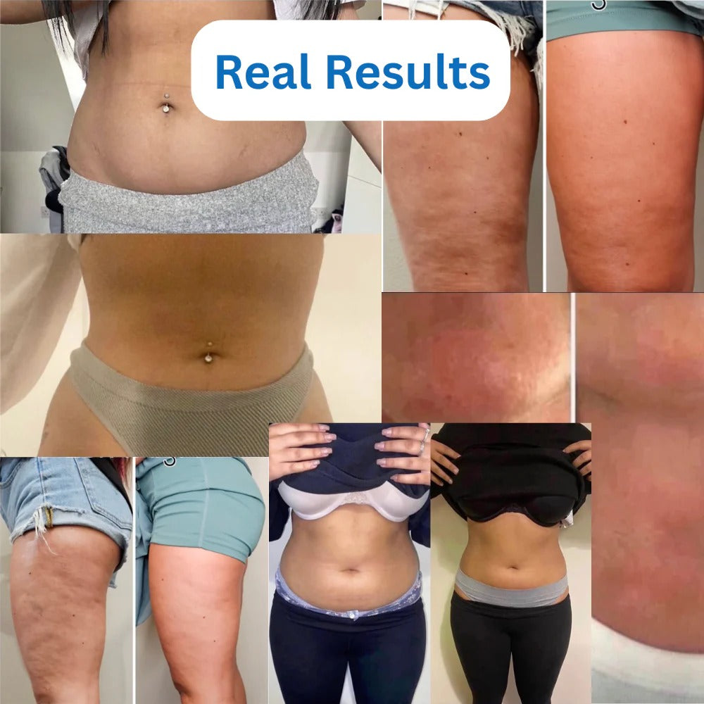 LipoBlast Ultrasonic Cavitation Machine