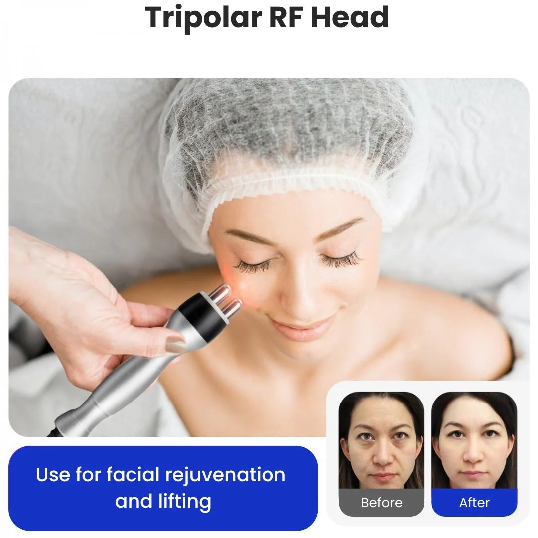 LipoBlast Ultrasonic Cavitation Machine