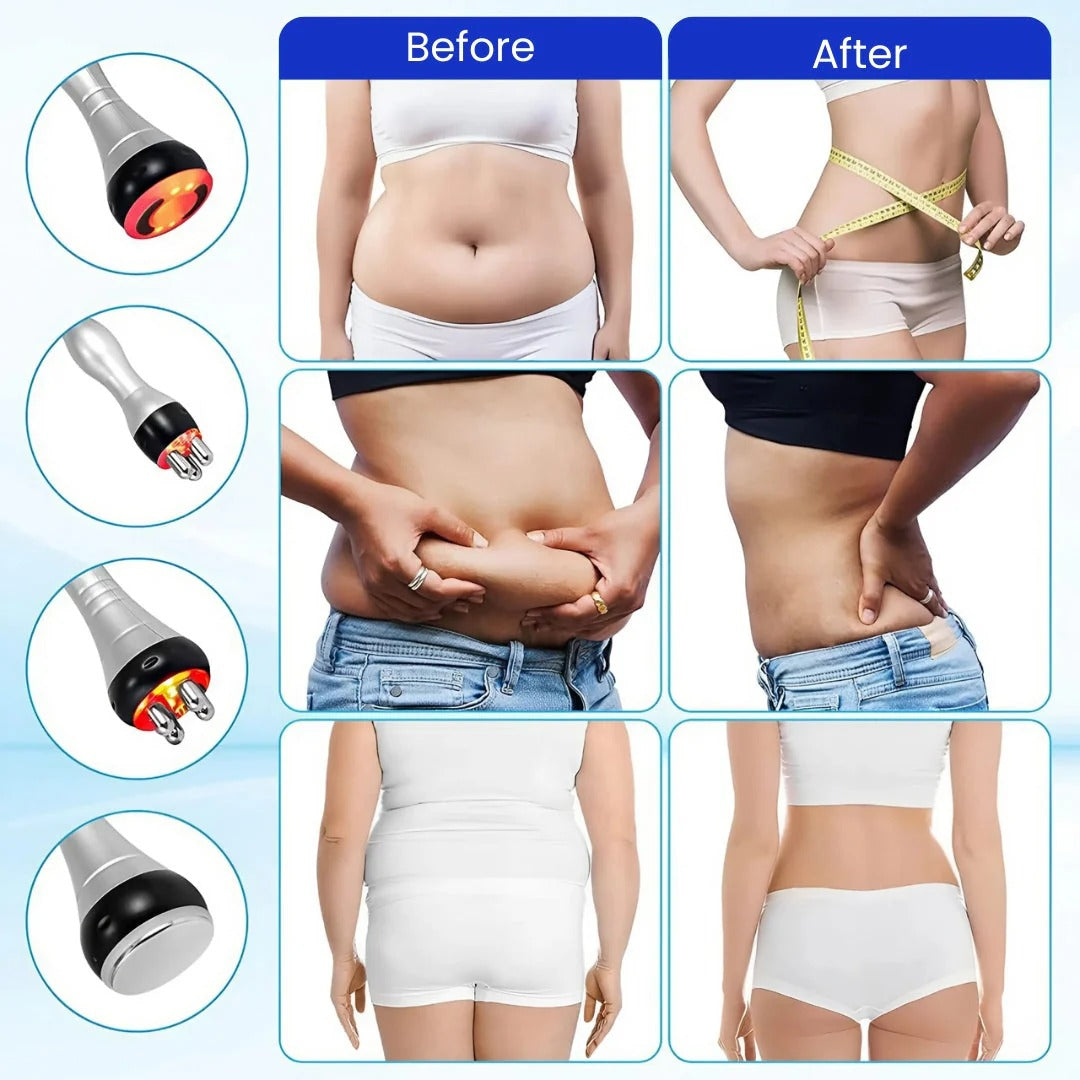 LipoBlast Ultrasonic Cavitation Machine